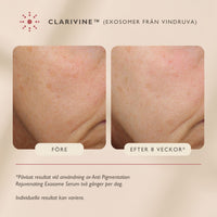 Anti Pigmentation Rejuvenating Exosome Serum