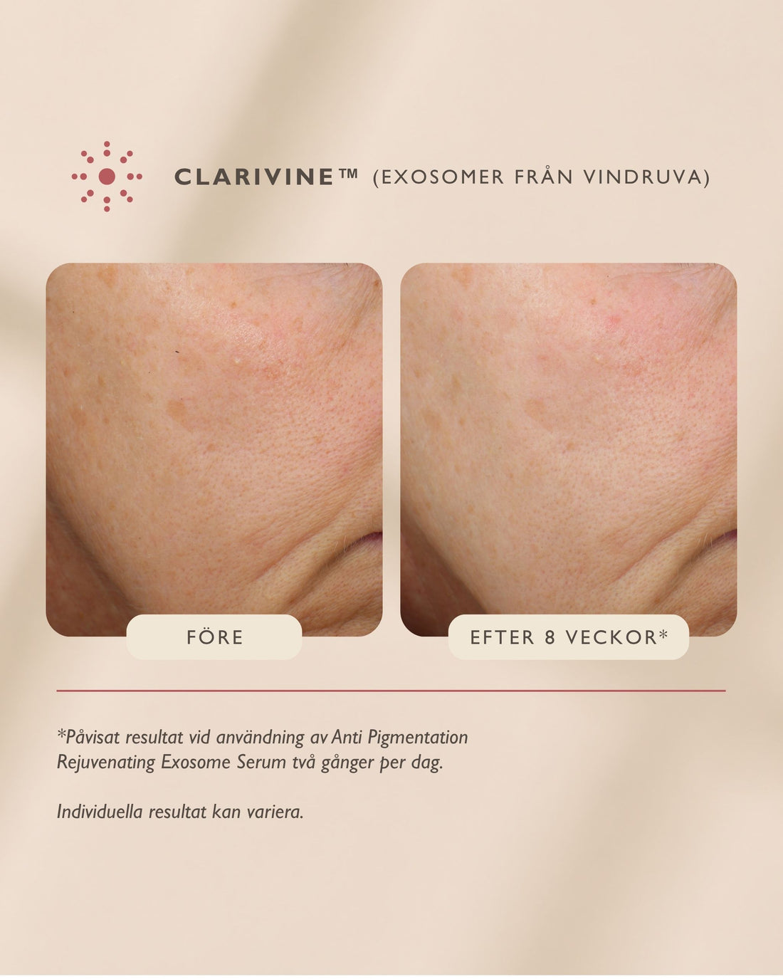 Anti Pigmentation Rejuvenating Exosome Serum
